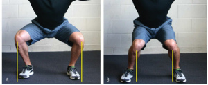 Knee valgus vs normal